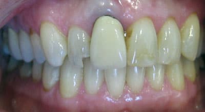 Restorative Dentistry Example