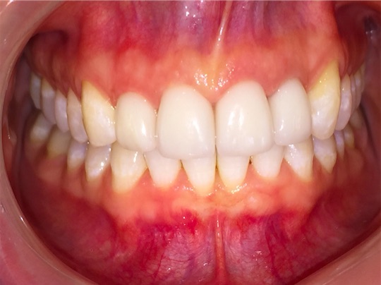 Cosmetic Dentistry Example