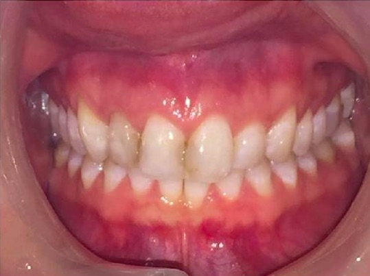 Cosmetic Dentistry Example